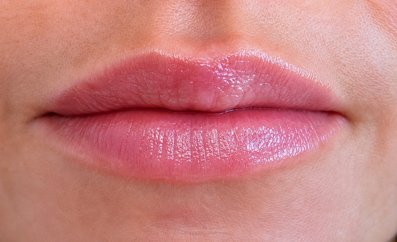 Lip enhancement